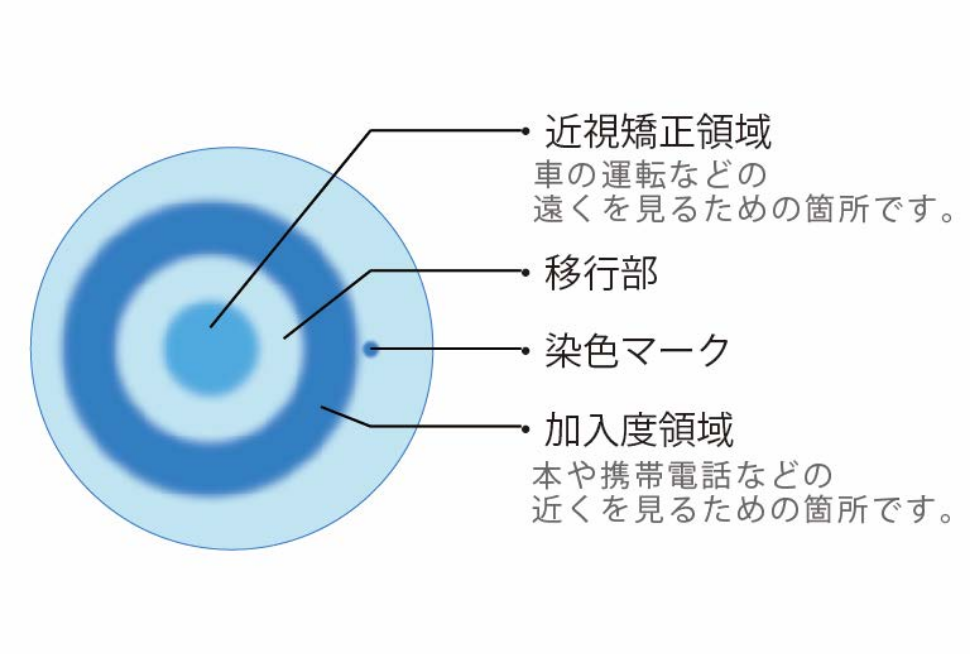 多焦点ソフトコンタクトレンズによる予防